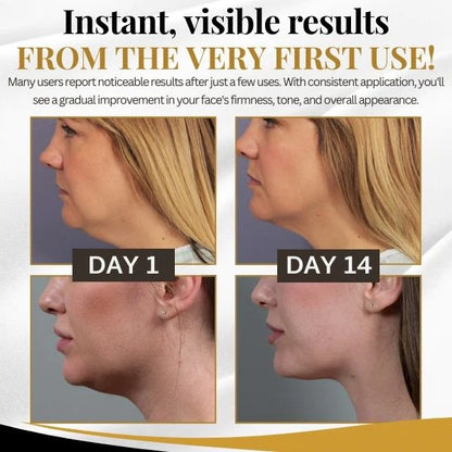 V-Shape™ Slimming Mask