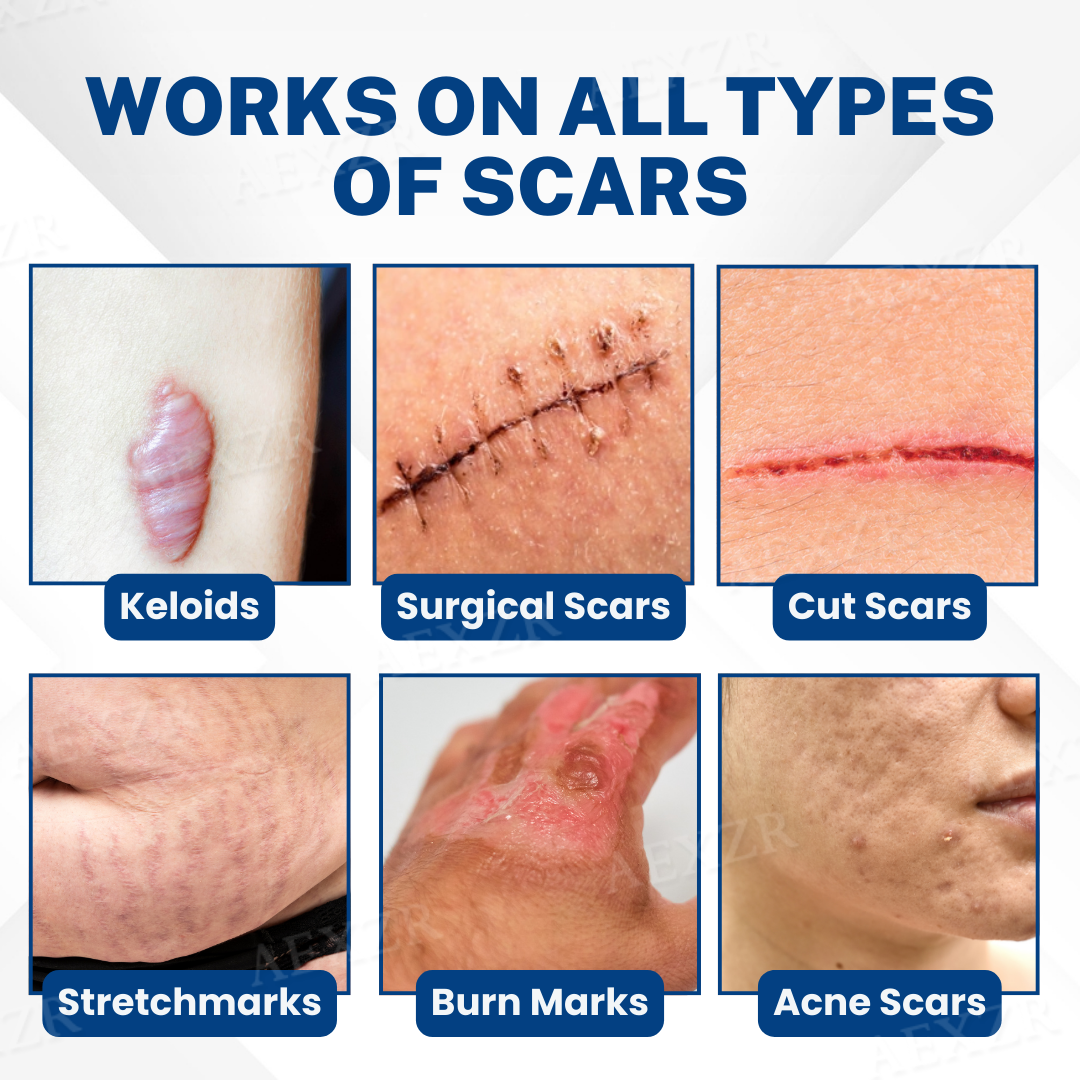 ScarPhix™ Scar Removal Cream