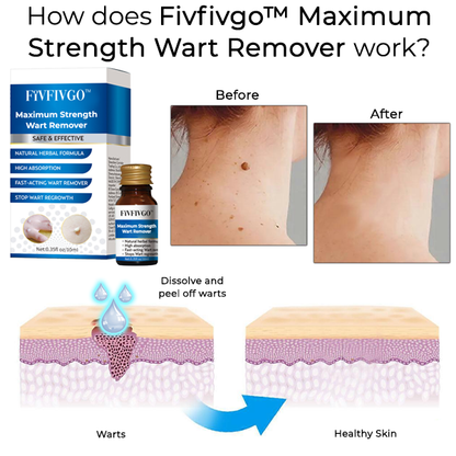 Fivfivgo™ Maximum Strength Wart Remover