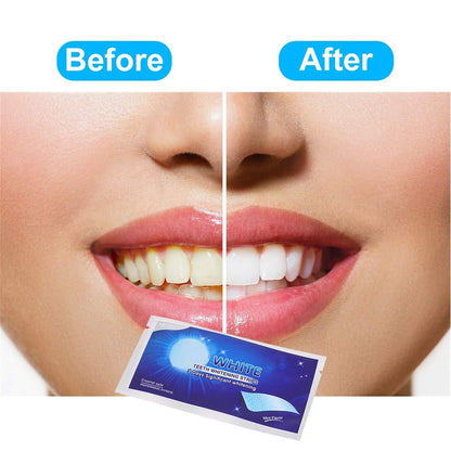 7PCS Teeth Whitening Strips【🇮🇳COD + Local Stock ！！!】