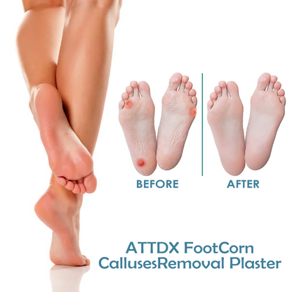 ATTDX FootCorn CallusesRemoval Plaster