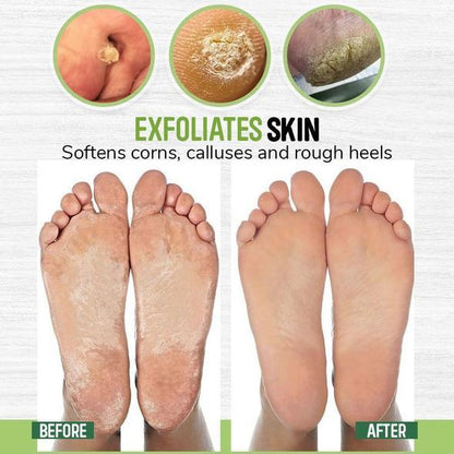 Anti-fungal Herbal Foot Soak