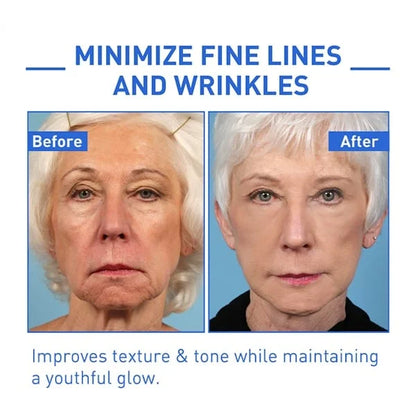 🔥Last Day Promotion 50% OFF - 🔥Deep Anti-Wrinkle Essence