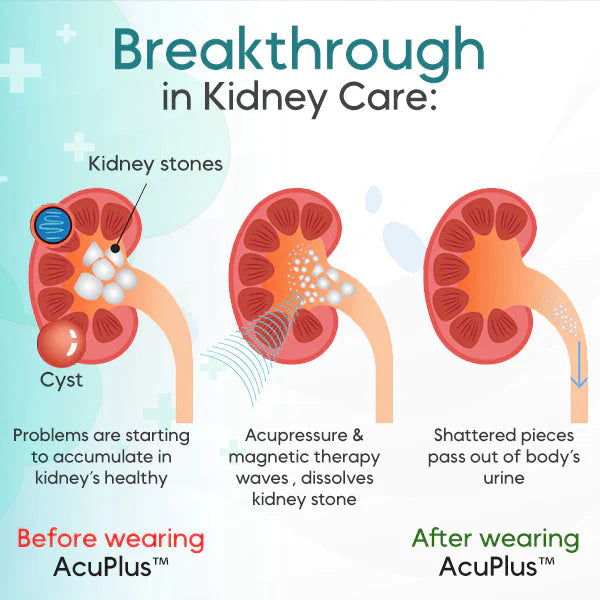 AcuPlus™ Kidney Care Point Clip